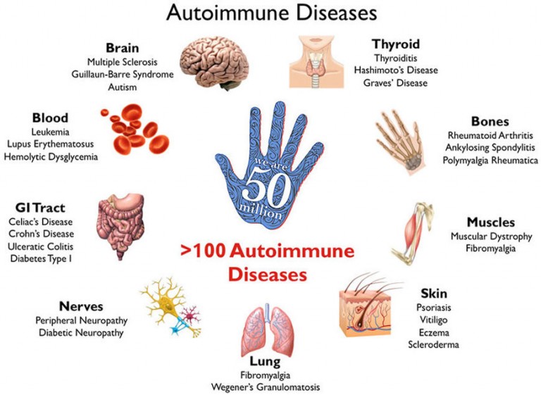 How To Say Autoimmune In Spanish